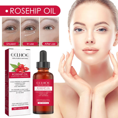 EELHOE Rosehip Facial Oil For Facial And Body Hydration, Nourishing skin care smooth Hair Care facial oil skin dryness skin elasticity EELHOE Rosehip Facial Oil body