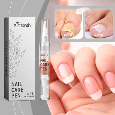Nail Care Pen Gentle Repair Nail Repair Body Care kit Nail care pen *1 colour classification: 3ml Product Name: Nail Care pen Nail Care Pen Gentle Repairs 